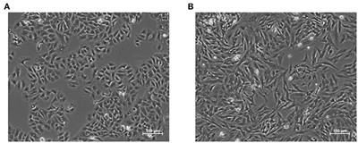 Identification via Numerical Computation of Transcriptional Determinants of a Cell Phenotype Decision Making